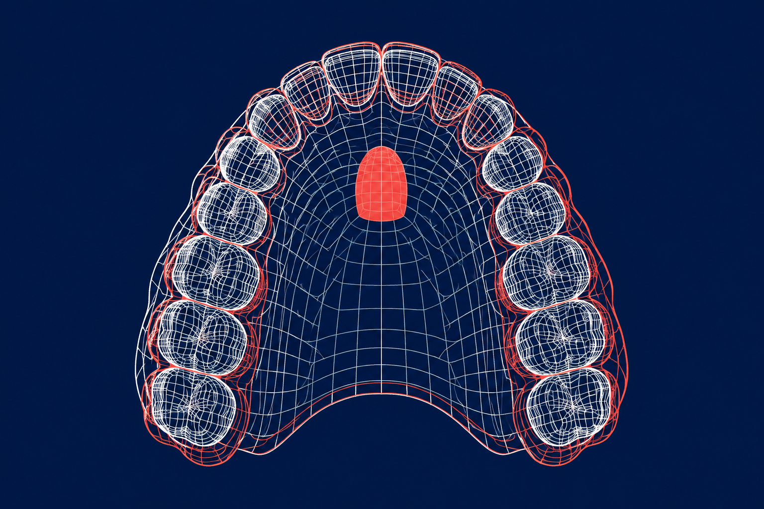 Overlaid dental meshes palatal reference