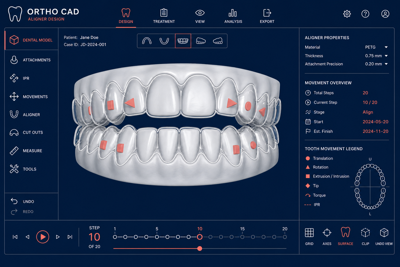 Virtual orthodontic design